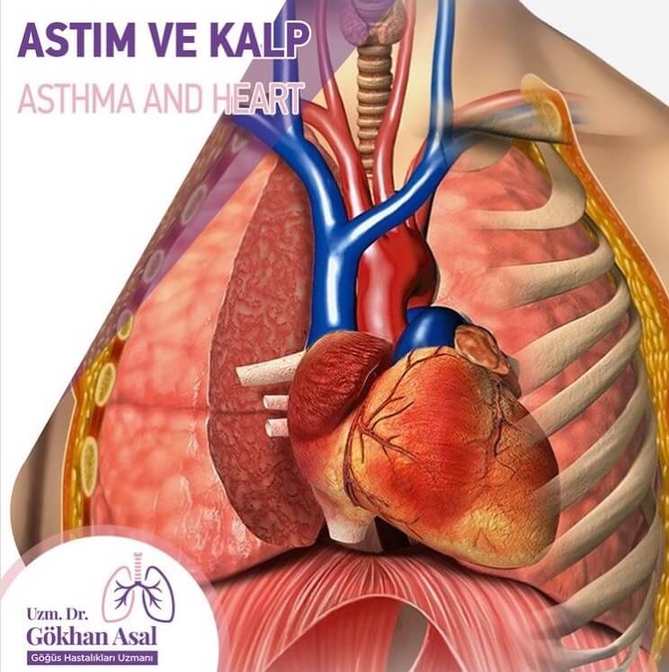 Antalya-Astım-ve-Kalp,Alerjik rinit ve astım belirtileri, ilacı